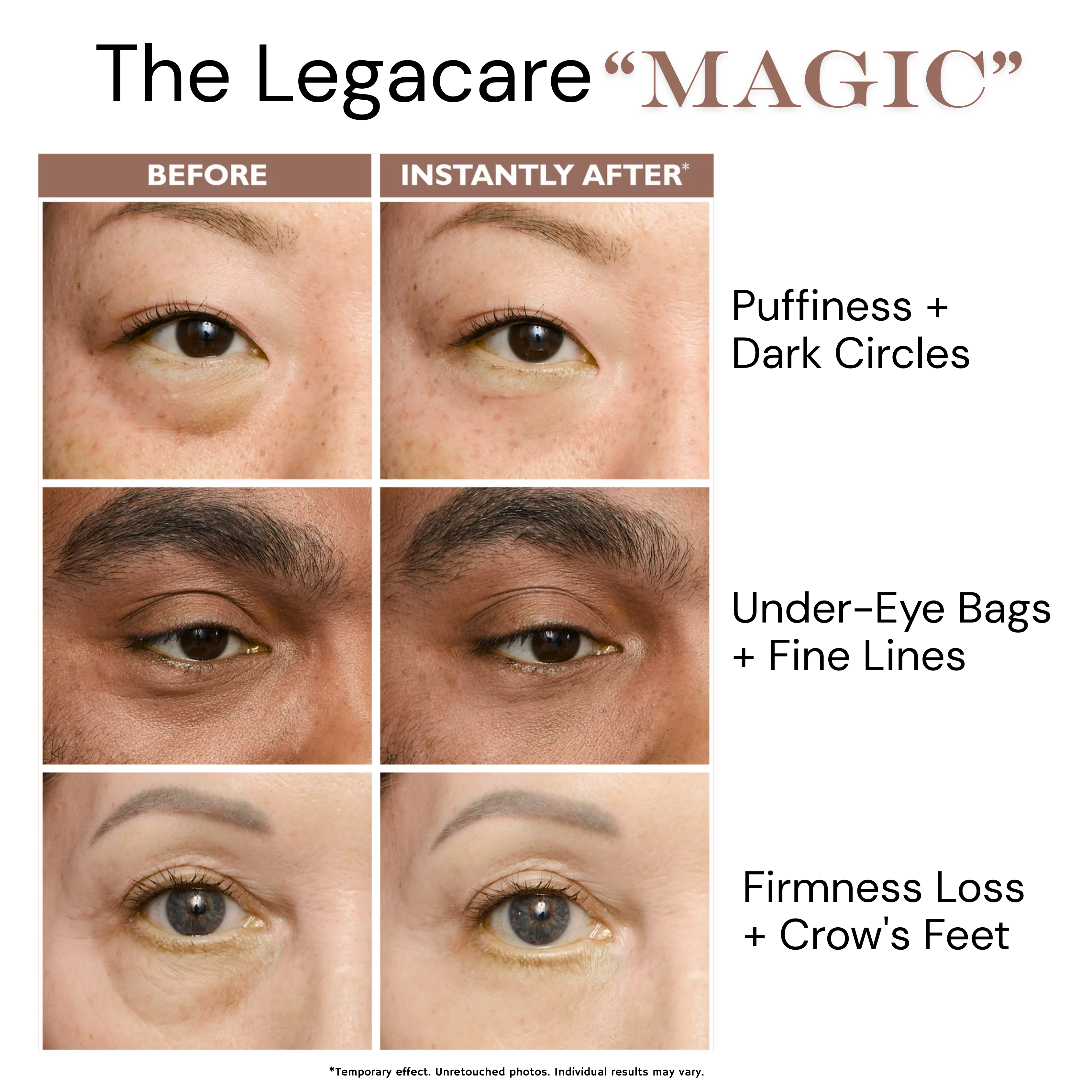 Temporary Eye Tightener