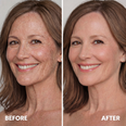 Changing Foundation benefits